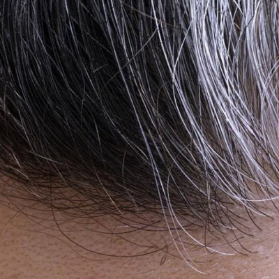Premature Greying of Hair: Causes & Tips for Treatments