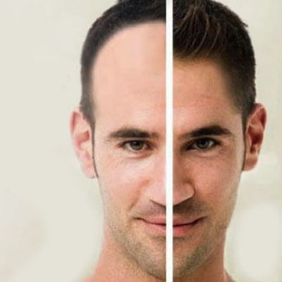 Can Masturbation Cause Hair Loss: Myths & Facts