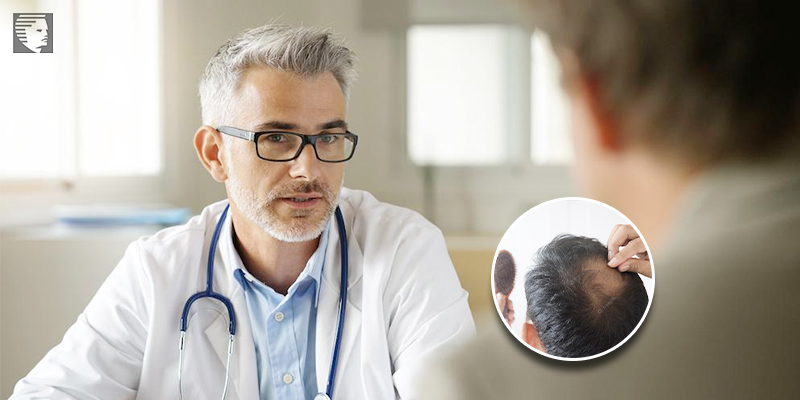 Understanding Receding Hairline and Potential Treatments