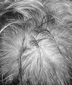 before-story-Shane Warne